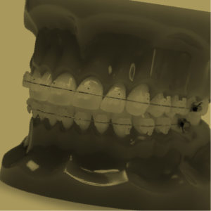 Other Accessories