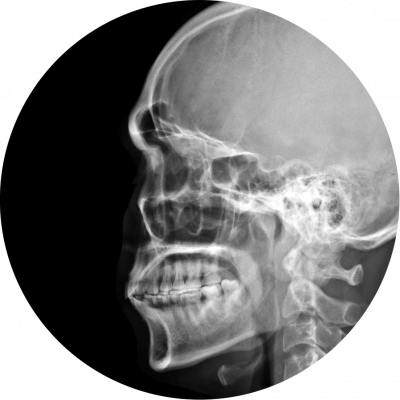 QST_CIRCLE_image_web_Xray